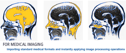 For Medical Imaging&mdash;Importing standard medical formats and instantly applying image processing operations