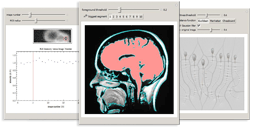 Interactive Medical Imaging Examples